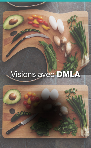 "traitement DMLA: vision avec dmla"